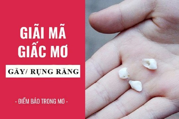 Mơ thấy rụng răng có ý nghĩa gì